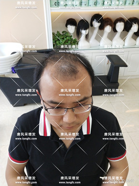 唐風(fēng)采假發(fā)效果能否達(dá)到預(yù)期？看看圖先！