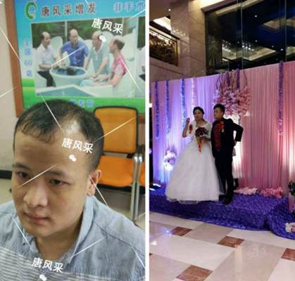 我還沒有脫單，怎么就脫發(fā)了呢?