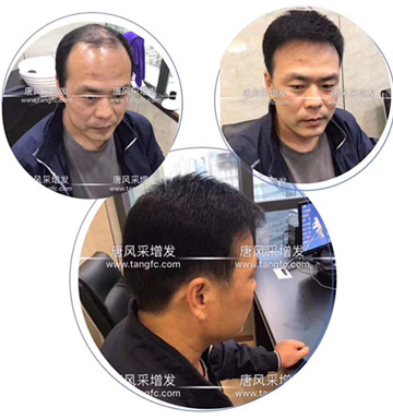 嘉興補(bǔ)發(fā)哪里好？請老司機(jī)幫忙推薦一下！