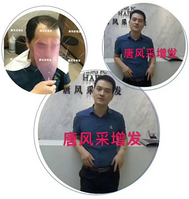 光禿禿的院子光禿禿的頭，與其羨慕不如改變！