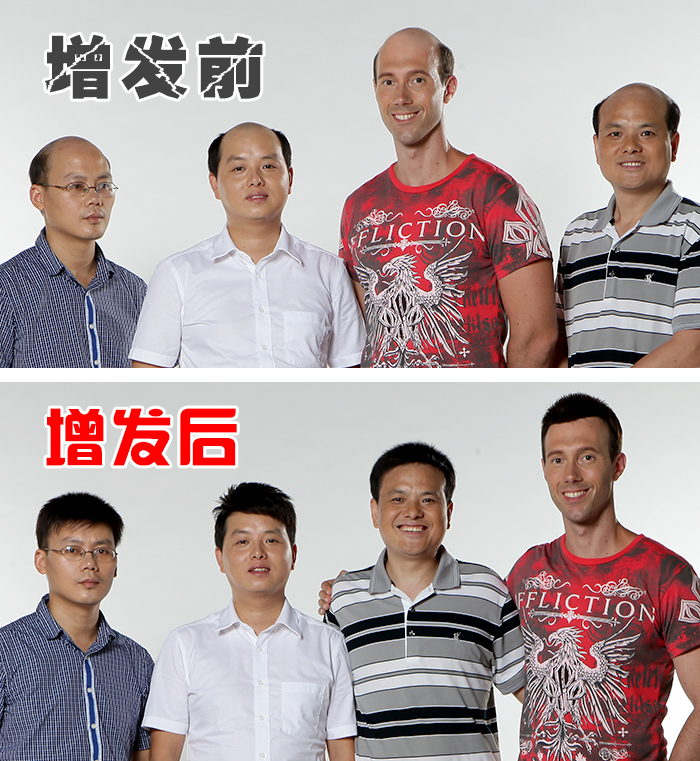 臺(tái)州賣假發(fā)的地方，有高檔真發(fā)假發(fā)賣嗎？