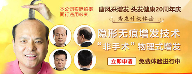 西寧補發(fā)哪里好誰知道？ 90后脫發(fā)了想做補發(fā)！