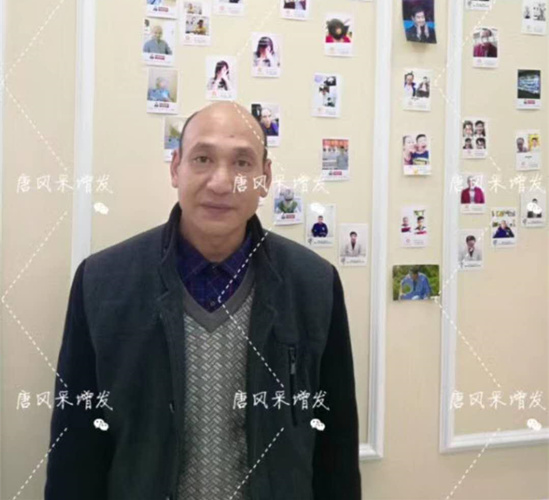 《我不是藥神》火了，山爭哥哥光頭變“藥神”成熱門話題！