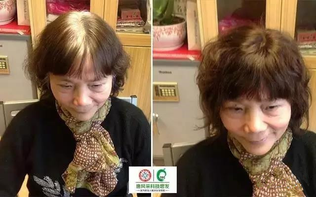 治白發(fā)不如遮白發(fā)，這個方法最有效！