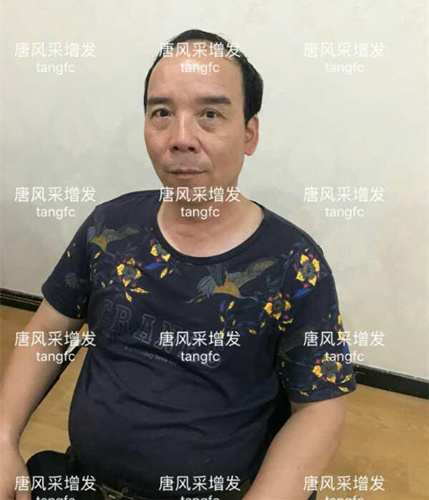 朋友碰面不敢認(rèn)，直擊發(fā)友增發(fā)后的真實(shí)改變！