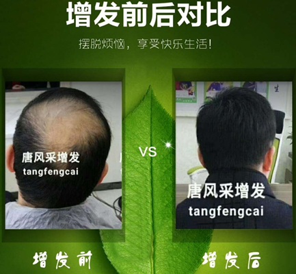 嘉興織發(fā)補發(fā)哪家好？發(fā)友們都“發(fā)”現(xiàn)了這家！