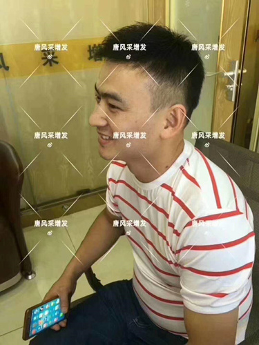 西寧織發(fā)補(bǔ)發(fā)哪家好，真的能改變我的脫發(fā)形象嗎？ 