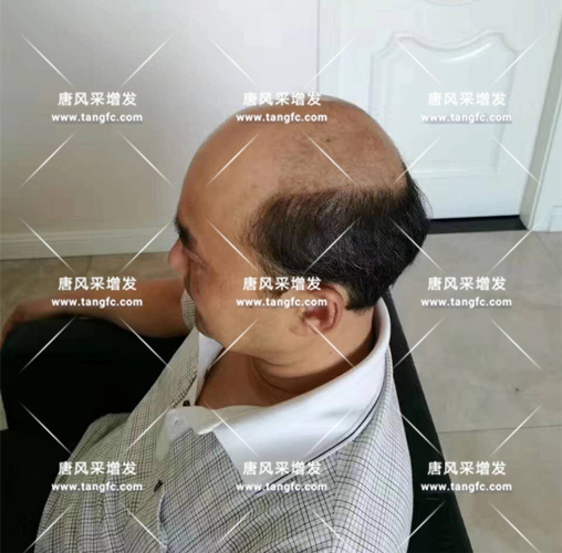 老年短假發(fā)全真發(fā)的好嗎？ 主要是用來(lái)遮白發(fā)的！