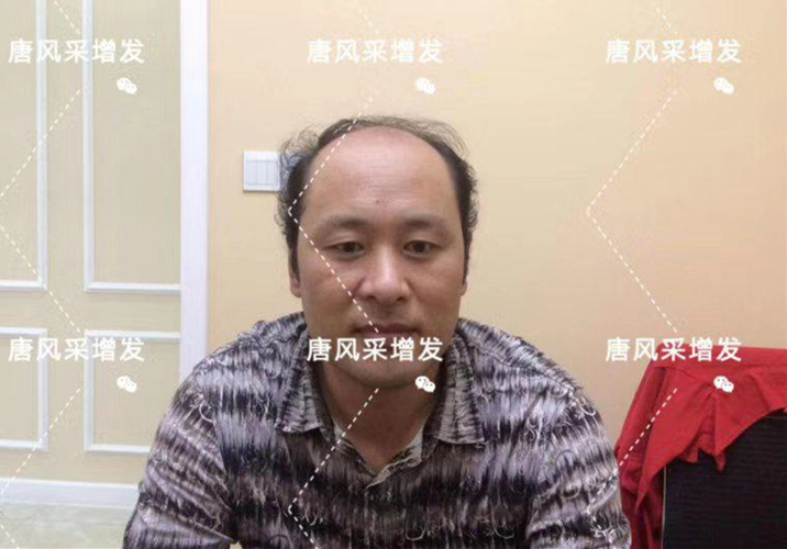 嘉興假發(fā)片定制哪家好？唐風采假發(fā)成了首選！