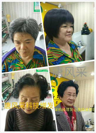 西寧假發(fā)專賣店哪家好，無痕真發(fā)假發(fā)跟一般發(fā)套有區(qū)別嗎