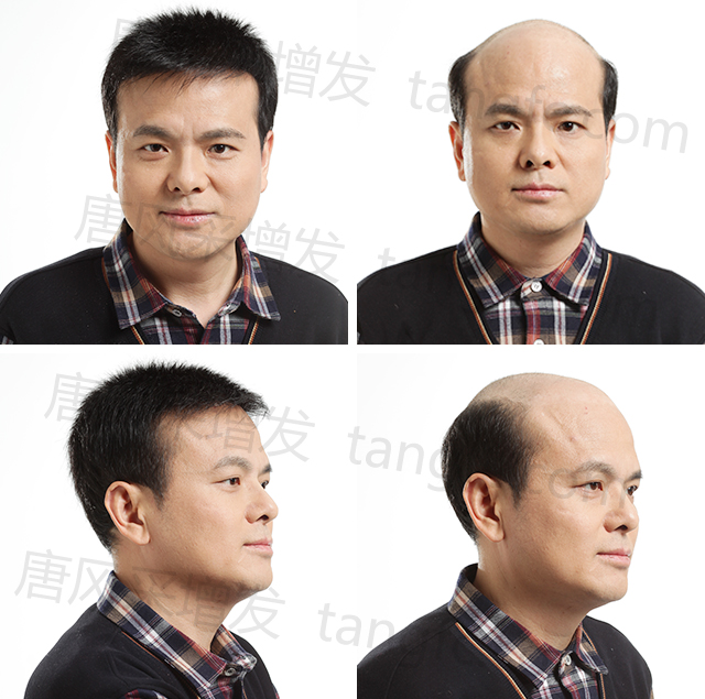 常剃光頭后，頭發(fā)變好了？這是視覺效果！