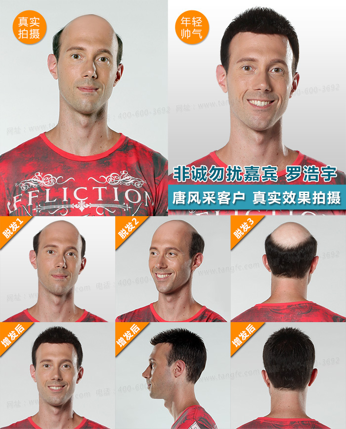 西寧假發(fā)片定制哪家好？ 為什么現(xiàn)在都不買(mǎi)成品假發(fā)了？