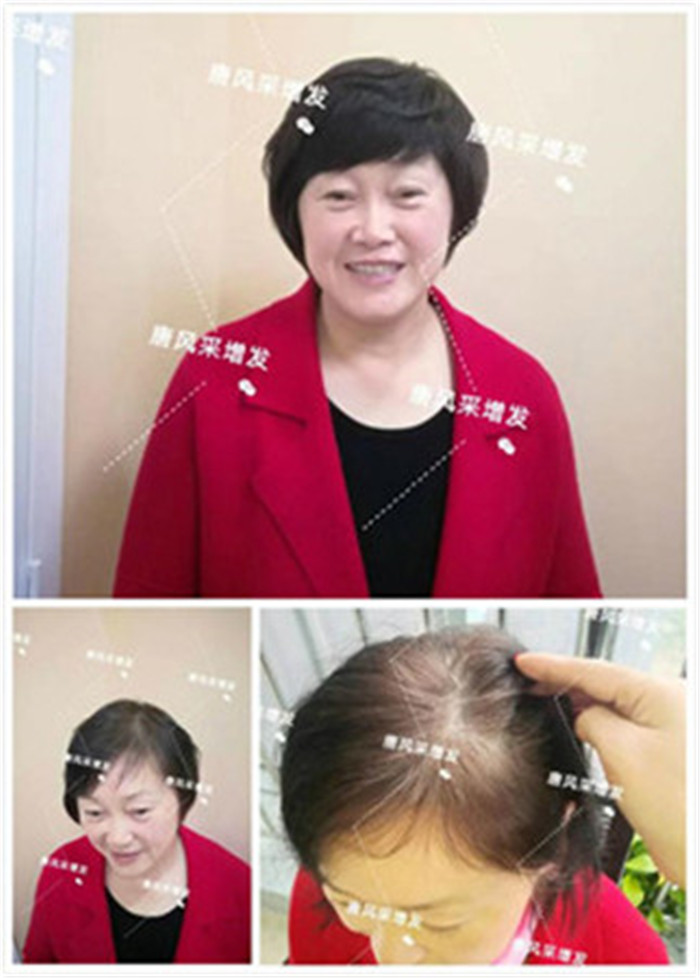 包頭假發(fā)什么牌子好？一定要選準(zhǔn)品牌精品