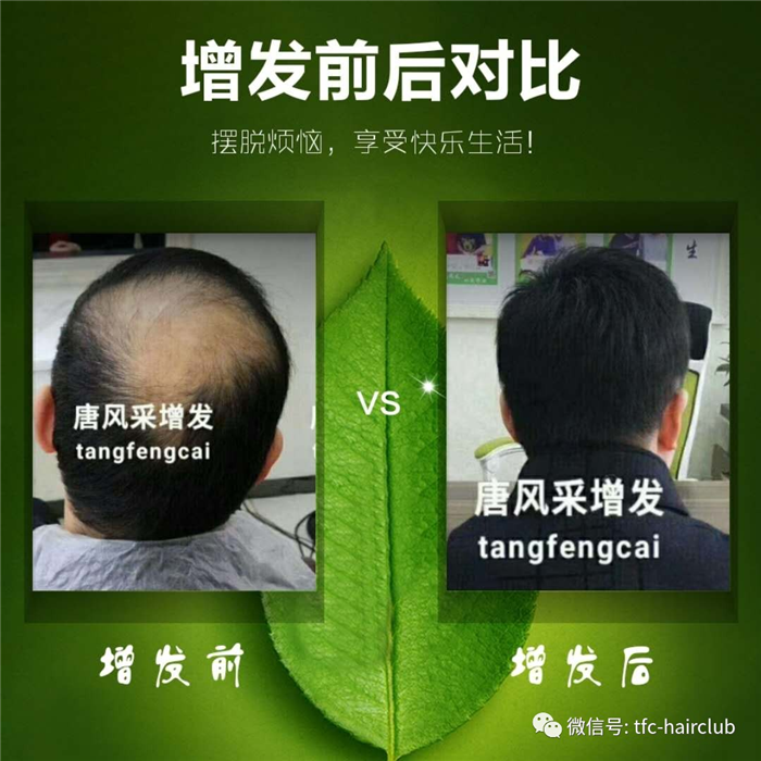 包頭哪里有真發(fā)假發(fā)套的專賣店？