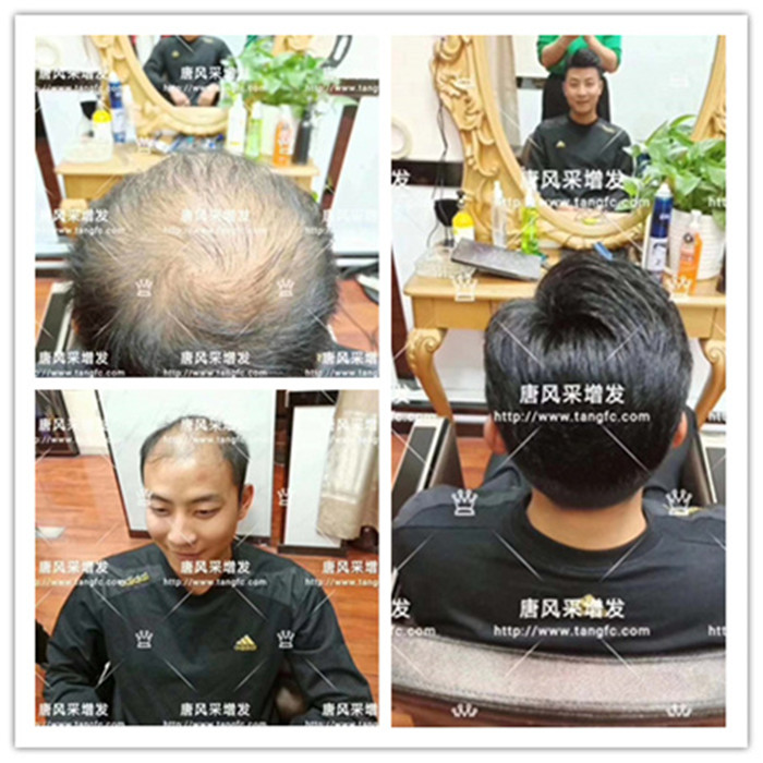 廈門好的織發(fā)店專業(yè)密發(fā)，連好朋友都看走眼了