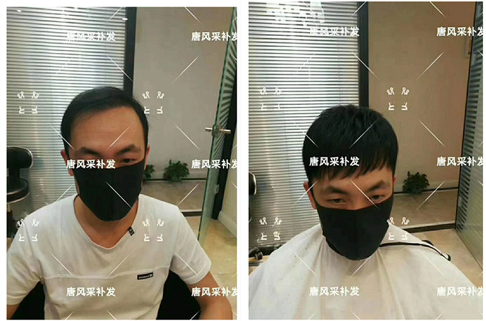 南昌哪里做真人假發(fā)的？脫發(fā)還是定制的好