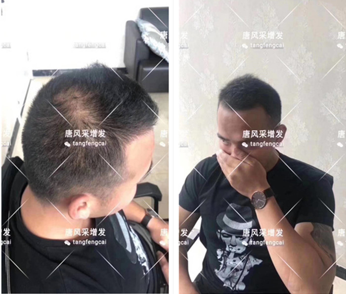 唐風采客戶增發(fā)對比圖