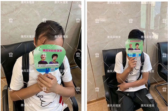 唐風(fēng)采假發(fā)后對(duì)比圖客戶