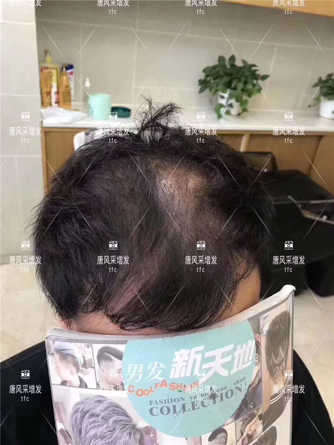 在唐風采假發(fā)后