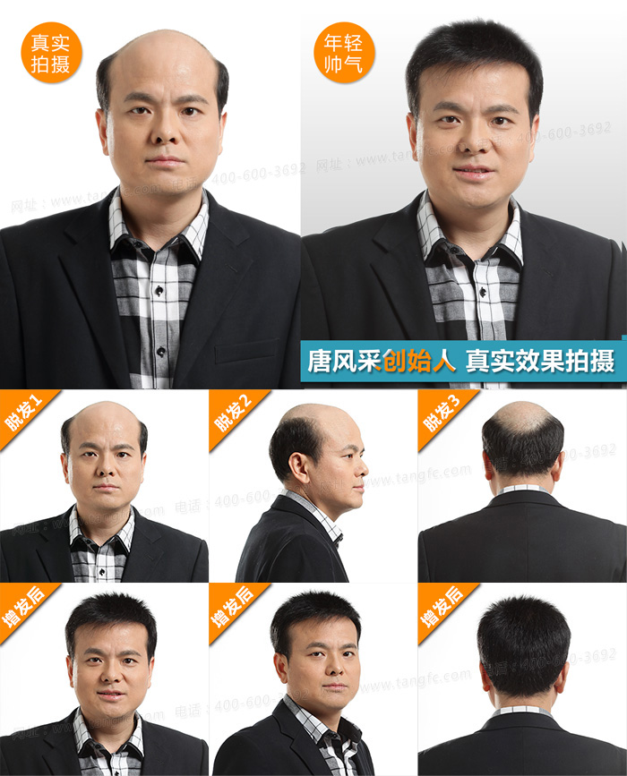 唐風采男士真發(fā)補發(fā)塊