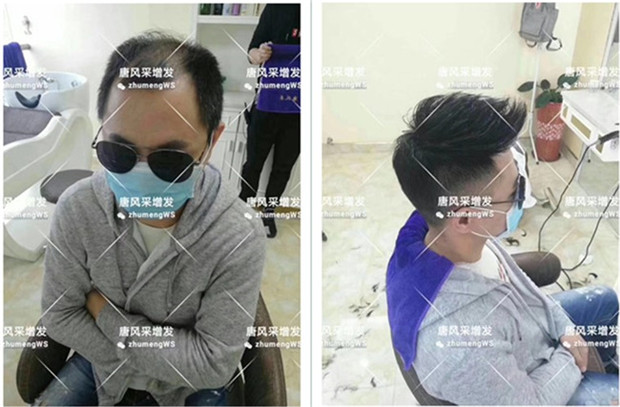 唐風采客戶案例小唐增發(fā)后