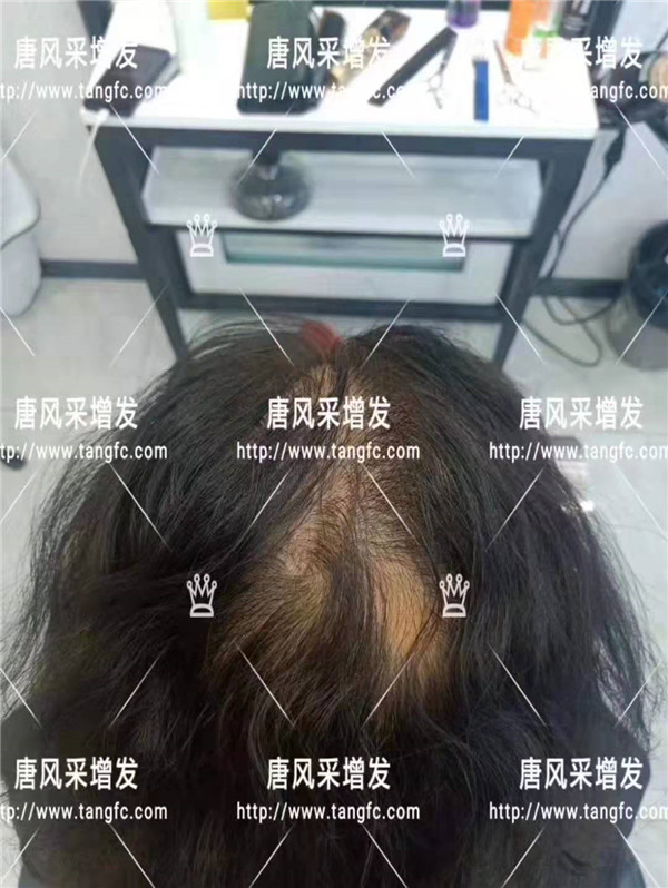 唐風(fēng)采無(wú)痕假發(fā)