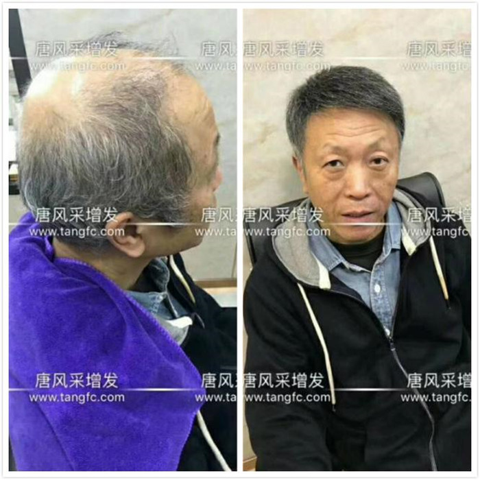 唐風(fēng)采真實案例