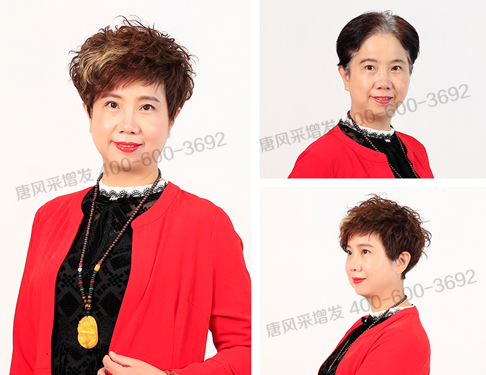 唐風采隱形增發(fā)效果真實自然