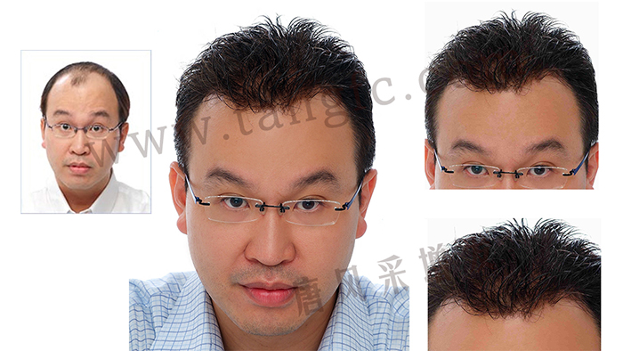 如果你hold不住謝頂，可以來試試真人頭發(fā)的假發(fā)