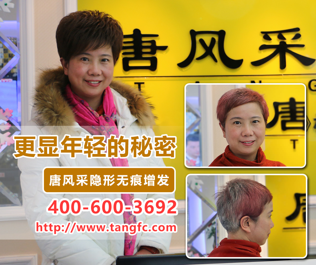 20歲就脫發(fā)怎么辦？蘭州專業(yè)補發(fā)哪家效果好？