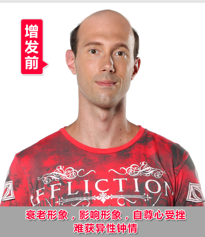 石家莊真人假發(fā)如何選？什么牌子值得推薦？